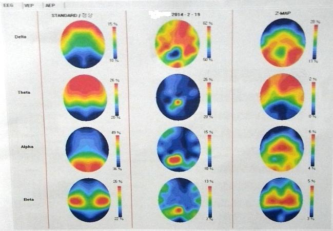 eeg-report