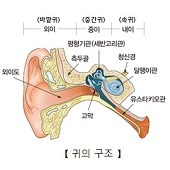 이석증?